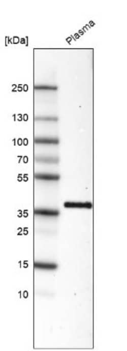 Activin C/Inhibin beta C Antibody (CL6915), Novus Biologicals 25 &mu;L;